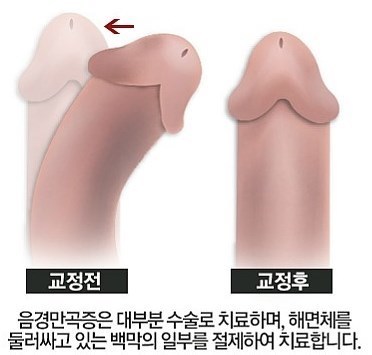 이미지명