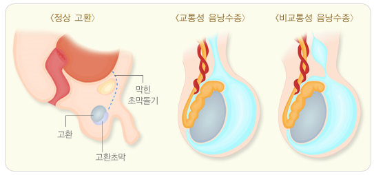 이미지명